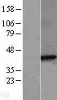 SGCB / SGC / Sarcoglycan Beta Protein - Western validation with an anti-DDK antibody * L: Control HEK293 lysate R: Over-expression lysate