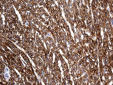 SGCD / Delta-Sarcoglycan Antibody - Immunohistochemical staining of paraffin-embedded Human adult heart tissue within the normal limits using anti-SGCD mouse monoclonal antibody. (Heat-induced epitope retrieval by 1mM EDTA in 10mM Tris buffer. (pH8.5) at 120 oC for 3 min. (1:500)