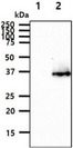SGCD / Delta-Sarcoglycan Antibody - The cell lysates (40ug) were resolved by SDS-PAGE, transferred to PVDF membrane and probed with anti-human SGCD antibody (1:1000). Proteins were visualized using a goat anti-mouse secondary antibody conjugated to HRP and an ECL detection system. Lane 1.: 293T cell lysate Lane 2.: SGCD transfected 293T cell lysate