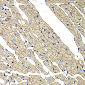 SGCD / Delta-Sarcoglycan Antibody - Immunohistochemistry of paraffin-embedded rat heart.