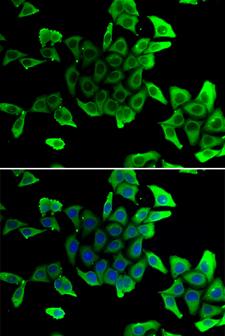 SGCD / Delta-Sarcoglycan Antibody - Immunofluorescence analysis of U20S cells.
