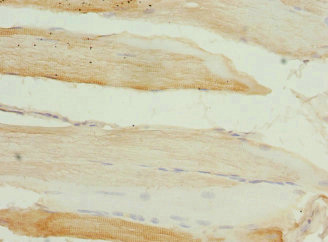 SGCD / Delta-Sarcoglycan Antibody - Immunohistochemistry of paraffin-embedded human skeletal muscle tissue at dilution 1:100