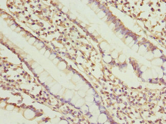 SGCD / Delta-Sarcoglycan Antibody - Immunohistochemistry of paraffin-embedded human small intestine at dilution 1:100
