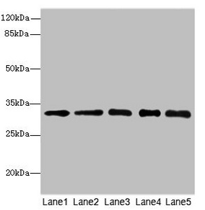 SGCD / Delta-Sarcoglycan Antibody - Western blot All Lanes: RRAS2antibody at 4.55ug/ml Lane 1 : Mouse kidney tissue Lane 2 : Mouse liver tissue Lane 3 : Mouse heart tissue Lane 4 : Jurkat whole cell lysate Lane 5 : Thp-1 whole cell lysate Secondary Goat polyclonal to Rabbit IgG at 1/10000 dilution Predicted band size: 33,29 kDa Observed band size: 32 kDa
