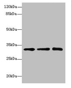 SGCD / Delta-Sarcoglycan Antibody - Western blot All lanes: RRAS2 antibody at 4.55µg/ml Lane 1: Mouse kidney tissue Lane 2: Mouse liver tissue Lane 3: Jurkat whole cell lysate Secondary Goat polyclonal to rabbit IgG at 1/10000 dilution Predicted band size: 33, 29 kDa Observed band size: 33 kDa