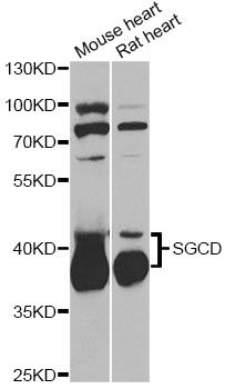SGCD / Delta-Sarcoglycan Antibody - Western blot analysis of extracts of various cell lines, using SGCD antibody at 1:1000 dilution. The secondary antibody used was an HRP Goat Anti-Rabbit IgG (H+L) at 1:10000 dilution. Lysates were loaded 25ug per lane and 3% nonfat dry milk in TBST was used for blocking. An ECL Kit was used for detection and the exposure time was 90s.