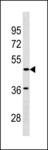 SGCE Antibody - SGCE Antibody western blot of A2058 cell line lysates (35 ug/lane). The SGCE antibody detected the SGCE protein (arrow).