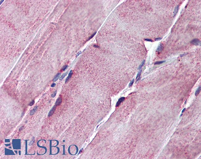 SGCE Antibody - Anti-SGCE antibody IHC of human skeletal muscle. Immunohistochemistry of formalin-fixed, paraffin-embedded tissue after heat-induced antigen retrieval. Antibody concentration 5 ug/ml.  This image was taken for the unconjugated form of this product. Other forms have not been tested.