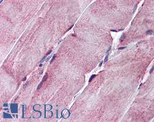 SGCE Antibody - Anti-SGCE antibody IHC of human skeletal muscle. Immunohistochemistry of formalin-fixed, paraffin-embedded tissue after heat-induced antigen retrieval. Antibody concentration 5 ug/ml.  This image was taken for the unconjugated form of this product. Other forms have not been tested.