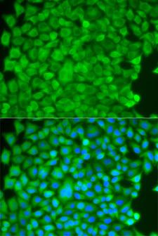SGCE Antibody - Immunofluorescence analysis of HeLa cells.