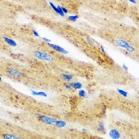 SGCE Antibody - Immunohistochemical analysis of Epsilon-sarcoglycan staining in mouse heart formalin fixed paraffin embedded tissue section. The section was pre-treated using heat mediated antigen retrieval with sodium citrate buffer (pH 6.0). The section was then incubated with the antibody at room temperature and detected using an HRP conjugated compact polymer system. DAB was used as the chromogen. The section was then counterstained with hematoxylin and mounted with DPX.