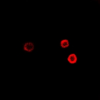 SGCE Antibody - Immunofluorescent analysis of Epsilon-sarcoglycan staining in HeLa cells. Formalin-fixed cells were permeabilized with 0.1% Triton X-100 in TBS for 5-10 minutes and blocked with 3% BSA-PBS for 30 minutes at room temperature. Cells were probed with the primary antibody in 3% BSA-PBS and incubated overnight at 4 deg C in a humidified chamber. Cells were washed with PBST and incubated with a DyLight 594-conjugated secondary antibody (red) in PBS at room temperature in the dark.