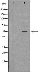 SGCE Antibody - Western blot analysis of HeLa whole cells lysates using SGCE antibody. The lane on the left is treated with the antigen-specific peptide.