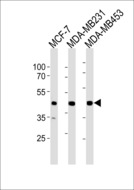 SGCG / Gamma-Sarcoglycan Antibody - SGCG Antibody western blot of MCF-7,MDA-MB231,MDA-MB453 cell line lysates (35 ug/lane). The SGCG antibody detected the SGCG protein (arrow).