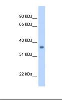 SGCG / Gamma-Sarcoglycan Antibody - Fetal heart cell lysate. Antibody concentration: 1.25 ug/ml. Gel concentration: 12%.  This image was taken for the unconjugated form of this product. Other forms have not been tested.