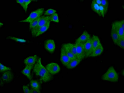 SGCG / Gamma-Sarcoglycan Antibody - Immunofluorescence staining of HepG2 cells diluted at 1:166, counter-stained with DAPI. The cells were fixed in 4% formaldehyde, permeabilized using 0.2% Triton X-100 and blocked in 10% normal Goat Serum. The cells were then incubated with the antibody overnight at 4°C.The Secondary antibody was Alexa Fluor 488-congugated AffiniPure Goat Anti-Rabbit IgG (H+L).