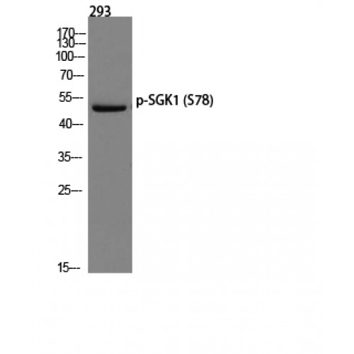 SGK1 / SGK Antibody - Western blot of Phospho-SGK1 (S78) antibody