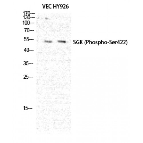 SGK1 / SGK Antibody - Western blot of Phospho-SGK1 (S422) antibody