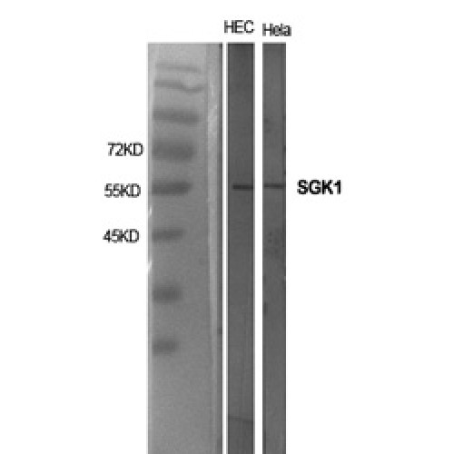 SGK1 / SGK Antibody - Western blot of SGK1 antibody