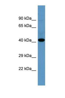 SGK1 / SGK Antibody - Western blot of Human Fetal Liver. SGK1 antibody dilution 1.0 ug/ml.  This image was taken for the unconjugated form of this product. Other forms have not been tested.