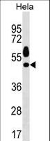 SGK1 / SGK Antibody - Mouse Sgk1 Antibody western blot of HeLa cell line lysates (35 ug/lane). The Sgk1 antibody detected the Sgk1 protein (arrow).
