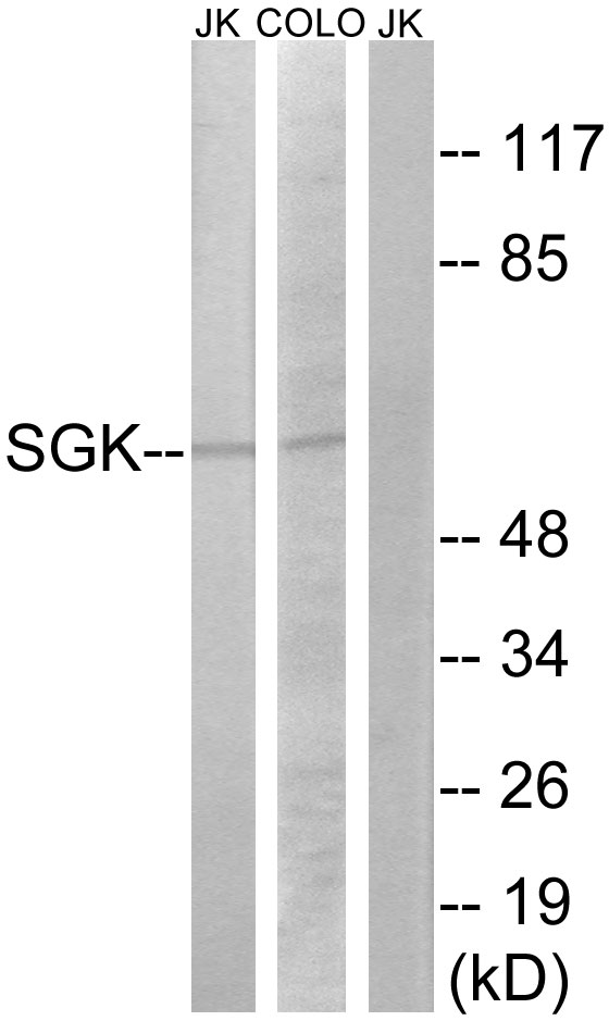 SGK1 / SGK Antibody - Western blot analysis of lysates from Jurkat and COLO205 cells, using SGK Antibody. The lane on the right is blocked with the synthesized peptide.