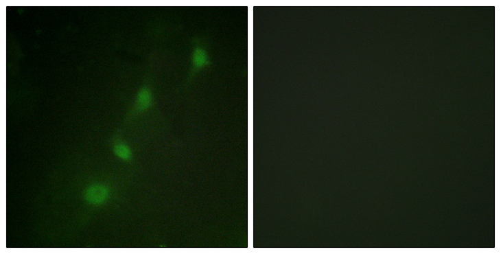 SGK1 / SGK Antibody - Immunofluorescence analysis of HeLa cells, using SGK Antibody. The picture on the right is blocked with the synthesized peptide.