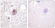 SGK1 / SGK Antibody - Immunohistochemistry analysis of paraffin-embedded human brain tissue, using SGK Antibody. The picture on the right is blocked with the synthesized peptide.