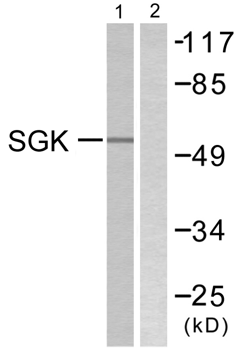SGK1 / SGK Antibody - Western blot analysis of lysates from 293 cells, treated with heat shock, using SGK Antibody. The lane on the right is blocked with the synthesized peptide.