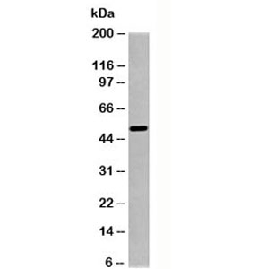 SGK1 / SGK Antibody - Western blot testing of human samples with SGK1 antibody at 1ug/ml.