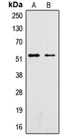 SGK1 / SGK Antibody - Western blot analysis of SGK1 (pS422) expression in A549 Insulin-treated (A); K562 Insulin-treated (B) whole cell lysates.