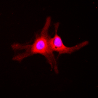 SGK1 / SGK Antibody - Immunofluorescent analysis of SGK1 (pS422) staining in HeLa cells. Formalin-fixed cells were permeabilized with 0.1% Triton X-100 in TBS for 5-10 minutes and blocked with 3% BSA-PBS for 30 minutes at room temperature. Cells were probed with the primary antibody in 3% BSA-PBS and incubated overnight at 4 C in a humidified chamber. Cells were washed with PBST and incubated with a DyLight 594-conjugated secondary antibody (red) in PBS at room temperature in the dark. DAPI was used to stain the cell nuclei (blue).