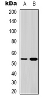 SGK1 / SGK Antibody - Western blot analysis of SGK1 expression in HeLa (A); Jurkat (B) whole cell lysates.