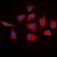SGK1 / SGK Antibody - Immunofluorescent analysis of SGK1 staining in HEK293T cells. Formalin-fixed cells were permeabilized with 0.1% Triton X-100 in TBS for 5-10 minutes and blocked with 3% BSA-PBS for 30 minutes at room temperature. Cells were probed with the primary antibody in 3% BSA-PBS and incubated overnight at 4 deg C in a humidified chamber. Cells were washed with PBST and incubated with a DyLight 594-conjugated secondary antibody (red) in PBS at room temperature in the dark. DAPI was used to stain the cell nuclei (blue).