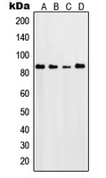 SGK1 / SGK Antibody - Western blot analysis of SGK1/2 expression in Jurkat (A); HeLa (B); NIH3T3 (C); PC12 (D) whole cell lysates.