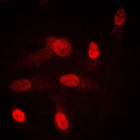 SGK1 / SGK Antibody - Immunofluorescent analysis of SGK1/2 staining in HeLa cells. Formalin-fixed cells were permeabilized with 0.1% Triton X-100 in TBS for 5-10 minutes and blocked with 3% BSA-PBS for 30 minutes at room temperature. Cells were probed with the primary antibody in 3% BSA-PBS and incubated overnight at 4 C in a humidified chamber. Cells were washed with PBST and incubated with a DyLight 594-conjugated secondary antibody (red) in PBS at room temperature in the dark. DAPI was used to stain the cell nuclei (blue).