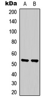 SGK1 / SGK Antibody - Western blot analysis of SGK1 expression in Jurkat (A); HepG2 (B) whole cell lysates.
