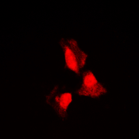 SGK1 / SGK Antibody - Immunofluorescent analysis of SGK1 staining in HepG2 cells. Formalin-fixed cells were permeabilized with 0.1% Triton X-100 in TBS for 5-10 minutes and blocked with 3% BSA-PBS for 30 minutes at room temperature. Cells were probed with the primary antibody in 3% BSA-PBS and incubated overnight at 4 deg C in a humidified chamber. Cells were washed with PBST and incubated with a DyLight 594-conjugated secondary antibody (red) in PBS at room temperature in the dark. DAPI was used to stain the cell nuclei (blue).
