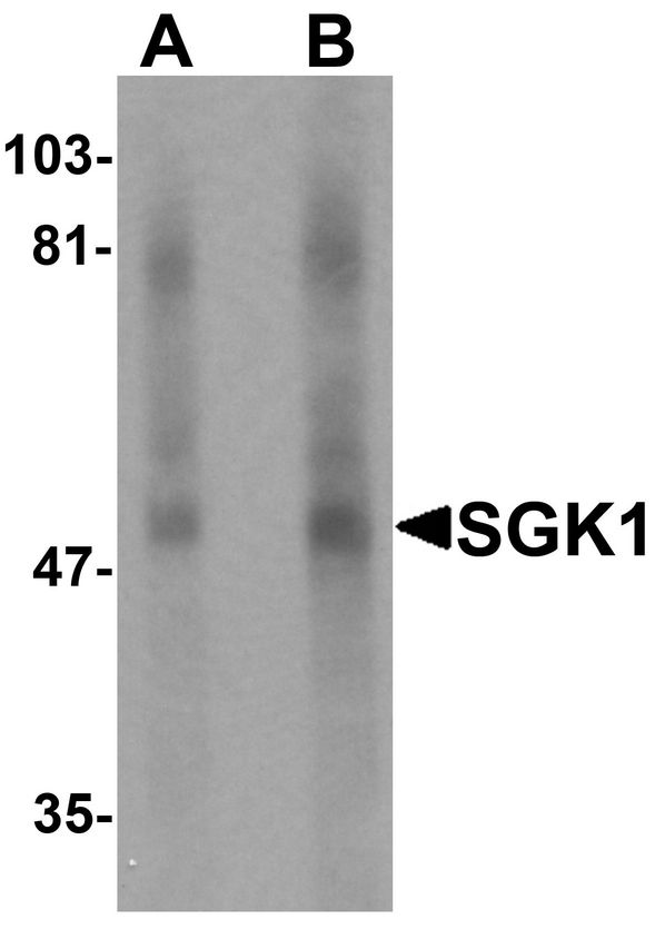 SGK1 / SGK Antibody - Western blot analysis of SGK1 in human stomach tissue lysate with SGK1 antibody at (A) 1 and (B) 2 ug/ml.