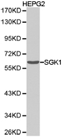 SGK1 / SGK Antibody - Western blot of HepG2 cell lysate using SGK1 antibody.