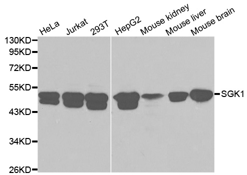SGK1 / SGK Antibody - Western blot analysis of extracts of various cell lines.