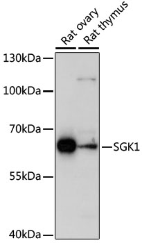 SGK1 / SGK Antibody - Western blot analysis of extracts of various cell lines, using SGK1 antibodyat 1:1000 dilution. The secondary antibody used was an HRP Goat Anti-Rabbit IgG (H+L) at 1:10000 dilution. Lysates were loaded 25ug per lane and 3% nonfat dry milk in TBST was used for blocking. An ECL Kit was used for detection and the exposure time was 30s.