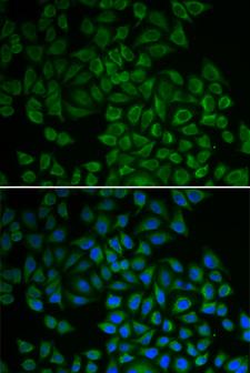 SGK1 / SGK Antibody - Immunofluorescence analysis of HeLa cells using SGK1 antibody. Blue: DAPI for nuclear staining.