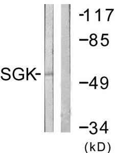 SGK1 / SGK Antibody - Western blot analysis of extracts from 293 cells, treated with heat shock, using SGK (Ab-78) antibody.