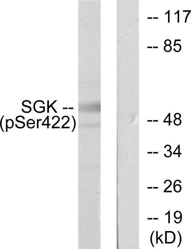 SGK1 / SGK Antibody - Western blot analysis of lysates from HeLa cells treated with Insulin 0.01U/ml 15', using SGK (Phospho-Ser422) Antibody. The lane on the right is blocked with the phospho peptide.