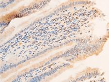 SGK1 / SGK Antibody - 1:100 staining rat Intestinal tissue by IHC-P. The tissue was formaldehyde fixed and a heat mediated antigen retrieval step in citrate buffer was performed. The tissue was then blocked and incubated with the antibody for 1.5 hours at 22°C. An HRP conjugated goat anti-rabbit antibody was used as the secondary.