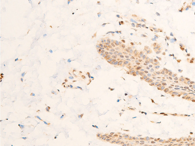 SGK1 / SGK Antibody - 1:100 staining human skin tissue by IHC-P. The tissue was formaldehyde fixed and a heat mediated antigen retrieval step in citrate buffer was performed. The tissue was then blocked and incubated with the antibody for 1.5 hours at 22°C. An HRP conjugated goat anti-rabbit antibody was used as the secondary.