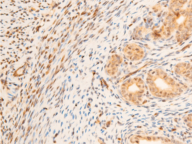 SGK1 / SGK Antibody - 1:100 staining rat uterine tissue by IHC-P. The tissue was formaldehyde fixed and a heat mediated antigen retrieval step in citrate buffer was performed. The tissue was then blocked and incubated with the antibody for 1.5 hours at 22°C. An HRP conjugated goat anti-rabbit antibody was used as the secondary.