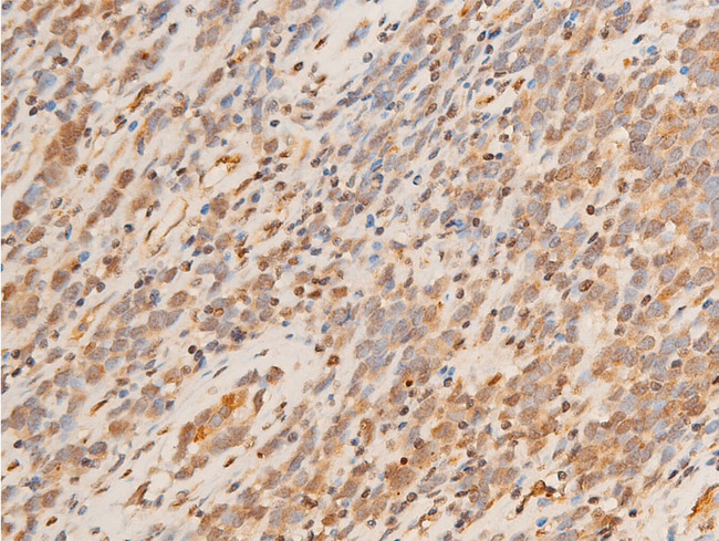 SGK1 / SGK Antibody - 1:100 staining human appendix tissue by IHC-P. The tissue was formaldehyde fixed and a heat mediated antigen retrieval step in citrate buffer was performed. The tissue was then blocked and incubated with the antibody for 1.5 hours at 22°C. An HRP conjugated goat anti-rabbit antibody was used as the secondary.