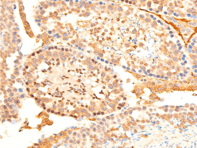 SGK1 / SGK Antibody - 1:100 staining mouse testis tissue by IHC-P. The tissue was formaldehyde fixed and a heat mediated antigen retrieval step in citrate buffer was performed. The tissue was then blocked and incubated with the antibody for 1.5 hours at 22°C. An HRP conjugated goat anti-rabbit antibody was used as the secondary.